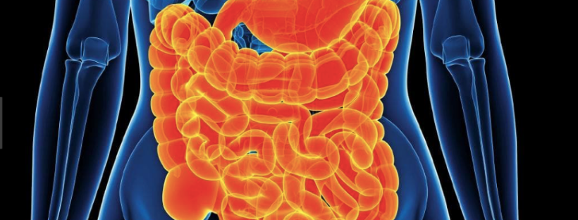 IBS, GI Distress, and Low FODMAP Diet